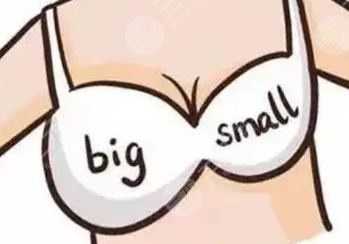 胸型大小不一样怎么办