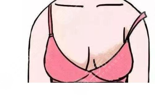 胸型大小不一样怎么办