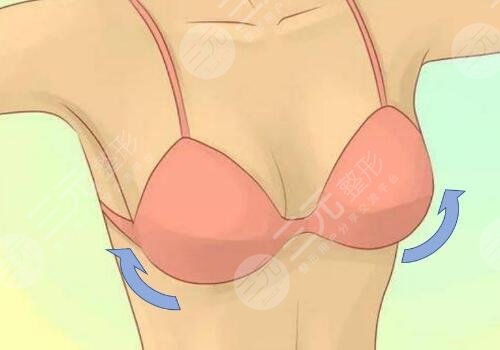 胸型大小不一样怎么办