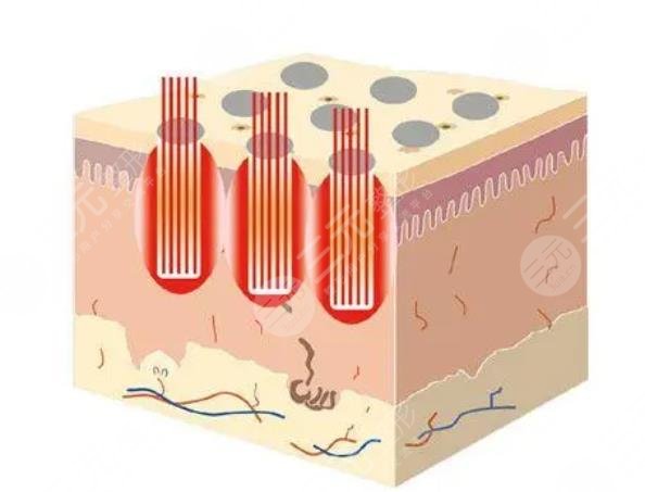 郑州第一人民医院整形科擅长项目科普
