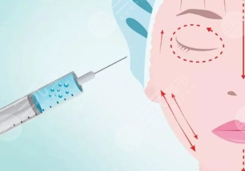 外轮廓固定提升有哪些手术方案？