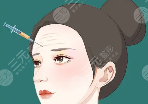 外轮廓提升需要几支玻尿酸？