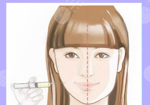 外轮廓提升需要几支玻尿酸？