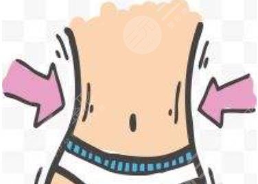 腰腹抽脂