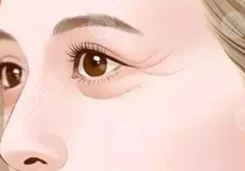 薇旖美可以注射眼部周围的皱纹不？