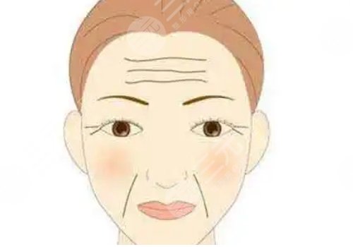 双美胶原蛋白填充泪沟能维持多久