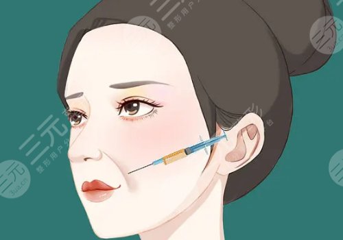 双美胶原蛋白填充泪沟能维持多久