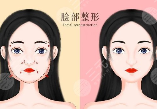 全脸幼态脸打造大概需要多少费用?