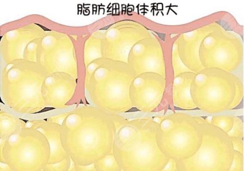 自体隆胸可以保持几年？