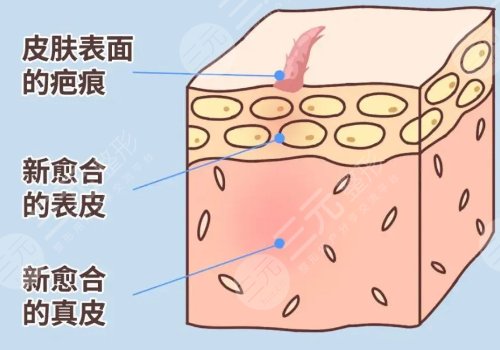 浙医二院整形外科疤痕专家