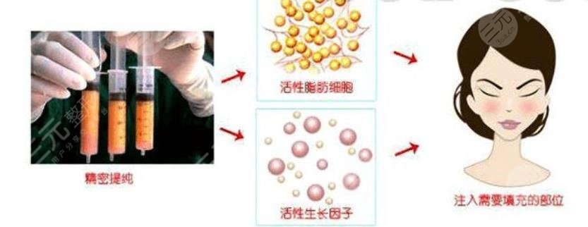 北京大学人民医院整形科擅长项目科普