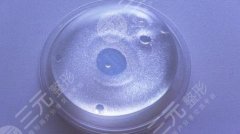 艾斯美乳房假体隆胸后怎样？今天就来了解一下！