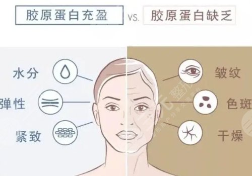 肤美达和双美的区别