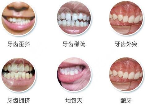 牙齿