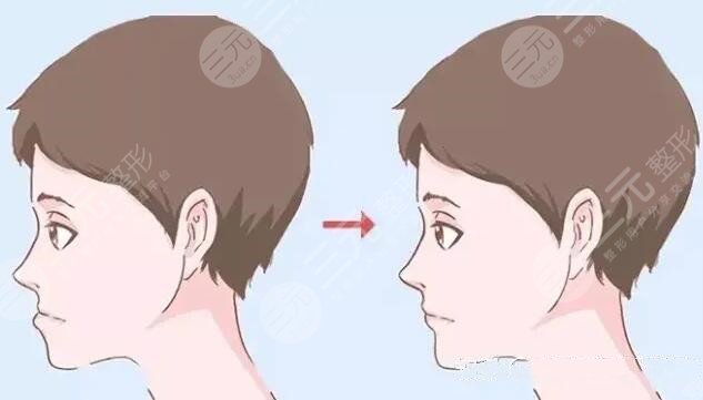 郑广森正颌手术多少钱？医生技术优势/正颌真人案例评价