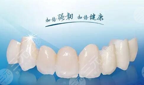 烤瓷牙多少钱一颗价格表2023查询！牙齿修复必备~