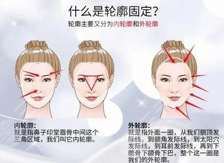 脸部轮廓固定能维持多久？