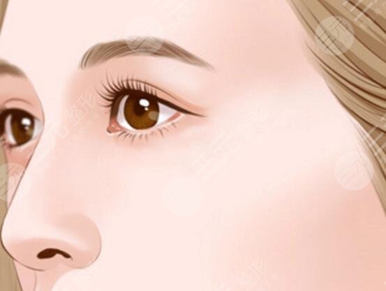 自体软骨隆鼻之后能够维持多长时间?