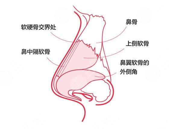 八大处王克明做鼻子风格