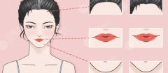 怎么整形成好看的嘴巴？美唇指南，教你重塑！