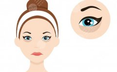 去除黑眼袋整形手术怎么做？2种方案分享，费用价格公开！