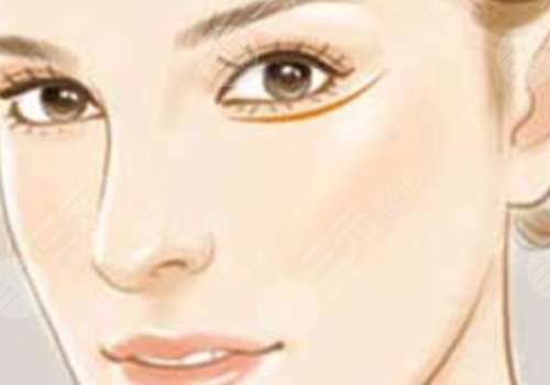 整鼻子鼻翼缩小多少钱