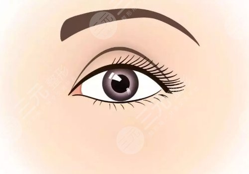 石杭燕双眼皮怎么样