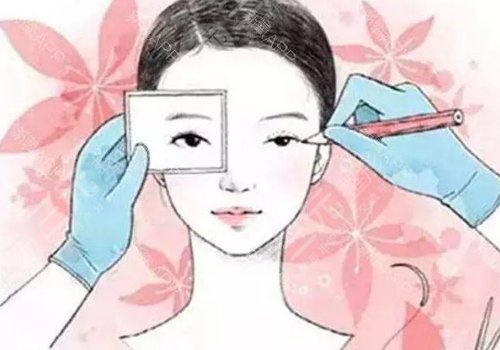 闫家峰做双眼皮怎么样