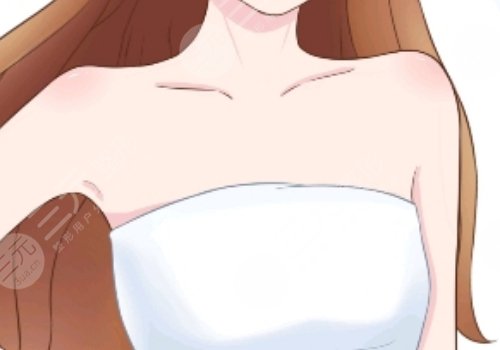 做直角肩多少钱?