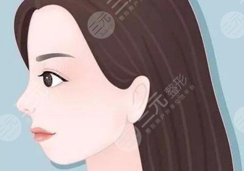 下巴后缩可以矫正过来吗?