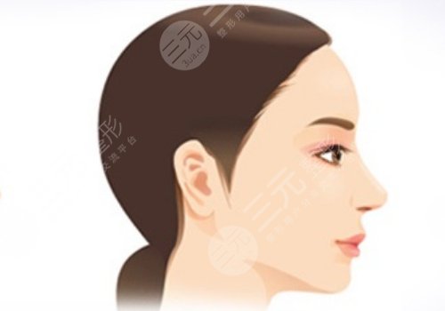 下巴后缩可以矫正过来吗?