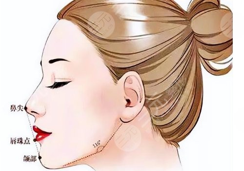 下巴后缩可以矫正过来吗?