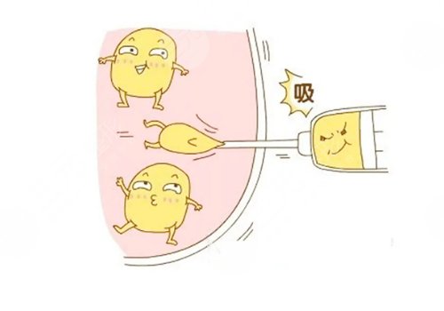 吸脂手术对身体有哪些危害?