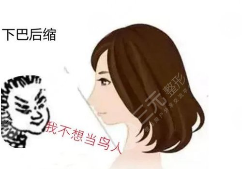 下巴后缩是什么原因造成的