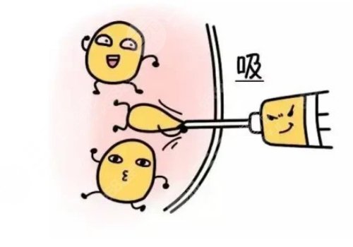 腰腹部抽脂对身体有什么伤害？