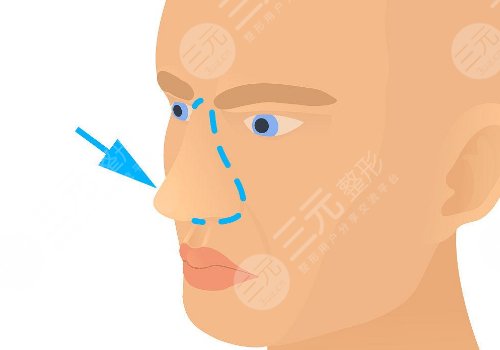 浙江省中医院整形科好不好？