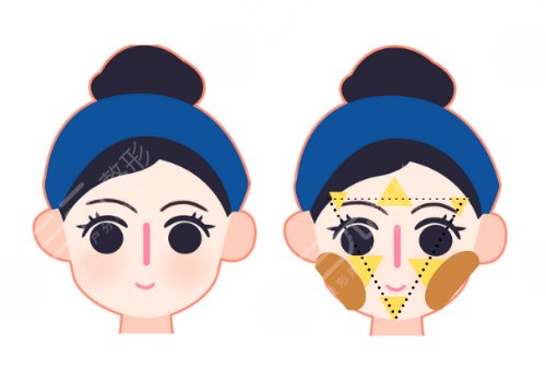 高面部折叠度怎么测