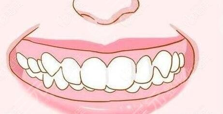 牙齿矫正