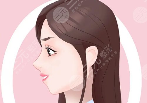 下巴后缩嘴凸怎么改良