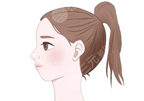 下巴后缩嘴凸怎么改良