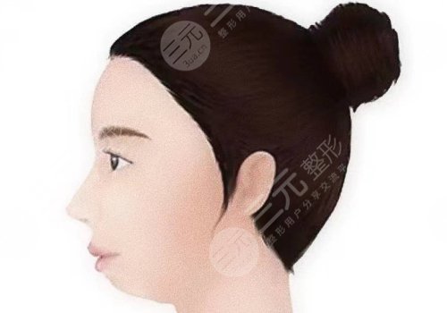 下巴后缩嘴凸怎么改良