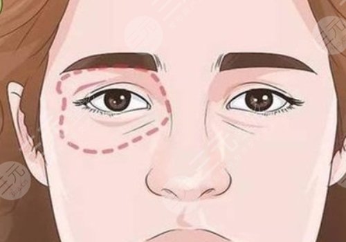 闫家峰医生厉害么？