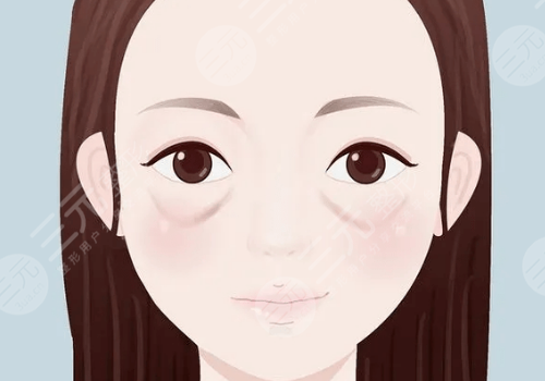 葛艳娜医生祛眼袋怎么样?