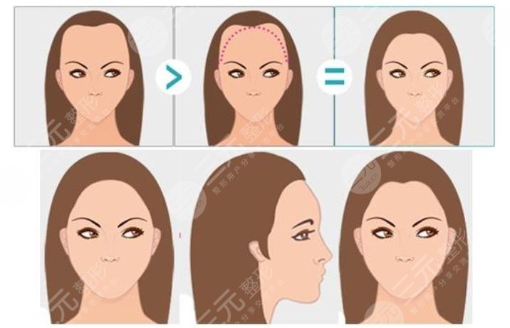 上海华山医院皮肤科擅长项目