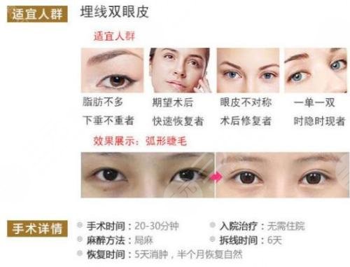 上海九医院整复外科双眼皮手术介绍