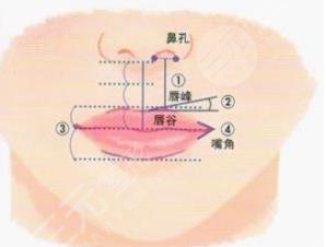 丰唇