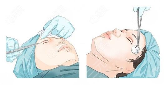 面部折叠度高好看吗