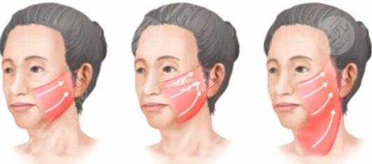 陈兵医生擅长项目介绍