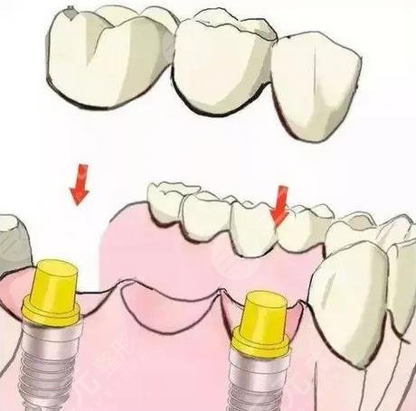 上海仁济医院口腔科擅长科普知识