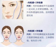 双矢量提升效果好吗?拉皮除皱新选择,手术原理科普! 双矢量提升效果好吗?拉皮除皱新选择,手术原理科普!